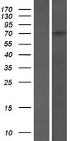 SCAI Protein - Western validation with an anti-DDK antibody * L: Control HEK293 lysate R: Over-expression lysate