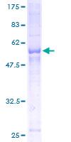 SCAMP2 Protein - 12.5% SDS-PAGE of human SCAMP2 stained with Coomassie Blue