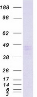 SCAMP3 Protein - Purified recombinant protein SCAMP3 was analyzed by SDS-PAGE gel and Coomassie Blue Staining