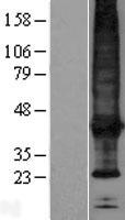 SCAMP4 Protein - Western validation with an anti-DDK antibody * L: Control HEK293 lysate R: Over-expression lysate