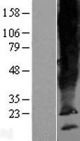 SCAMP5 Protein - Western validation with an anti-DDK antibody * L: Control HEK293 lysate R: Over-expression lysate