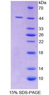 SCARA5 Protein - Recombinant  Scavenger Receptor Class A Member 5 By SDS-PAGE