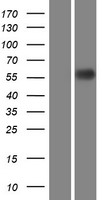 SCARB1 / SR-BI Protein - Western validation with an anti-DDK antibody * L: Control HEK293 lysate R: Over-expression lysate