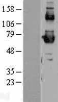 SCARB1 / SR-BI Protein - Western validation with an anti-DDK antibody * L: Control HEK293 lysate R: Over-expression lysate