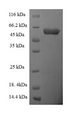 SCARB1 / SR-BI Protein - (Tris-Glycine gel) Discontinuous SDS-PAGE (reduced) with 5% enrichment gel and 15% separation gel.