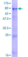 SCARB1 / SR-BI Protein - 12.5% SDS-PAGE of human SCARB1 stained with Coomassie Blue