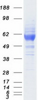 SCARB1 / SR-BI Protein - Purified recombinant protein SCARB1 was analyzed by SDS-PAGE gel and Coomassie Blue Staining