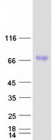 SCARB1 / SR-BI Protein - Purified recombinant protein SCARB1 was analyzed by SDS-PAGE gel and Coomassie Blue Staining