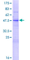 SCC4 / MAU2 Protein - 12.5% SDS-PAGE of human KIAA0892 stained with Coomassie Blue