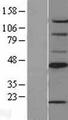 SCD1 / SCD Protein - Western validation with an anti-DDK antibody * L: Control HEK293 lysate R: Over-expression lysate