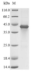 SCD1 / SCD Protein - (Tris-Glycine gel) Discontinuous SDS-PAGE (reduced) with 5% enrichment gel and 15% separation gel.