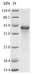 SCD1 / SCD Protein - (Tris-Glycine gel) Discontinuous SDS-PAGE (reduced) with 5% enrichment gel and 15% separation gel.