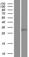 SCD5 / SCD4 Protein - Western validation with an anti-DDK antibody * L: Control HEK293 lysate R: Over-expression lysate