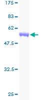 SCEH / ECHS1 Protein - 12.5% SDS-PAGE of human ECHS1 stained with Coomassie Blue