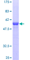 SCEH / ECHS1 Protein - 12.5% SDS-PAGE of human ECHS1 stained with Coomassie Blue