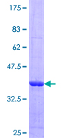 SCEH / ECHS1 Protein - 12.5% SDS-PAGE Stained with Coomassie Blue.