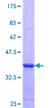SCEH / ECHS1 Protein - 12.5% SDS-PAGE Stained with Coomassie Blue.