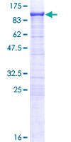 SCEL Protein - 12.5% SDS-PAGE of human SCEL stained with Coomassie Blue