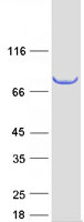 SCEL Protein - Purified recombinant protein SCEL was analyzed by SDS-PAGE gel and Coomassie Blue Staining