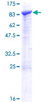 SCFD2 Protein - 12.5% SDS-PAGE of human SCFD2 stained with Coomassie Blue