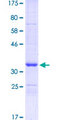 SCG10 / STMN2 Protein - 12.5% SDS-PAGE Stained with Coomassie Blue