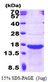 SCG10 / STMN2 Protein
