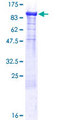 SCG2 / Secretogranin II Protein - 12.5% SDS-PAGE of human SCG2 stained with Coomassie Blue
