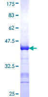 SCG2 / Secretogranin II Protein - 12.5% SDS-PAGE Stained with Coomassie Blue.