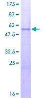 SCG5 / 7B2 Protein - 12.5% SDS-PAGE of human SCG5 stained with Coomassie Blue