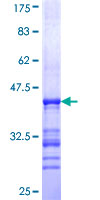 SCG5 / 7B2 Protein - 12.5% SDS-PAGE Stained with Coomassie Blue.