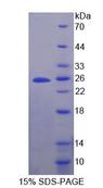 SCG5 / 7B2 Protein - Recombinant  Secretogranin V By SDS-PAGE