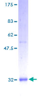 SCGB1A1 / Uteroglobin Protein - 12.5% SDS-PAGE of human SCGB1A1 stained with Coomassie Blue