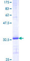 SCGB1A1 / Uteroglobin Protein - 12.5% SDS-PAGE of human SCGB1A1 stained with Coomassie Blue