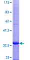 SCGB2A1 / Mammaglobin B Protein - 12.5% SDS-PAGE of human SCGB2A1 stained with Coomassie Blue