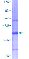 SCGB2A2 / Mammaglobin A Protein - 12.5% SDS-PAGE of human SCGB2A2 stained with Coomassie Blue