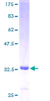 SCGB3A2 Protein - 12.5% SDS-PAGE of human SCGB3A2 stained with Coomassie Blue
