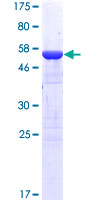 SCGN / Secretagogin Protein - 12.5% SDS-PAGE of human SCGN stained with Coomassie Blue