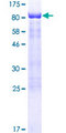SCHIP1 Protein - 12.5% SDS-PAGE of human SCHIP1 stained with Coomassie Blue