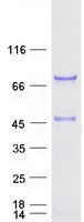 SCHIP1 Protein - Purified recombinant protein SCHIP1 was analyzed by SDS-PAGE gel and Coomassie Blue Staining