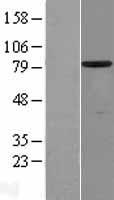 SCIN Protein - Western validation with an anti-DDK antibody * L: Control HEK293 lysate R: Over-expression lysate