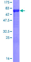 SCIN Protein - 12.5% SDS-PAGE of human SCIN stained with Coomassie Blue