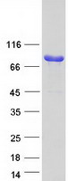 SCIN Protein - Purified recombinant protein SCIN was analyzed by SDS-PAGE gel and Coomassie Blue Staining