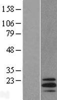 SCLIP / STMN3 Protein - Western validation with an anti-DDK antibody * L: Control HEK293 lysate R: Over-expression lysate