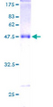 SCLIP / STMN3 Protein - 12.5% SDS-PAGE of human STMN3 stained with Coomassie Blue