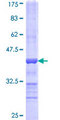 SCLY Protein - 12.5% SDS-PAGE Stained with Coomassie Blue.