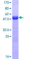 SCML1 Protein - 12.5% SDS-PAGE of human SCML1 stained with Coomassie Blue