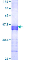 SCML1 Protein - 12.5% SDS-PAGE Stained with Coomassie Blue.