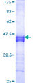 SCML1 Protein - 12.5% SDS-PAGE Stained with Coomassie Blue.