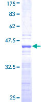 SCML2 Protein - 12.5% SDS-PAGE Stained with Coomassie Blue.