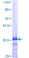 SCN11A / Nav1.9 Protein - 12.5% SDS-PAGE Stained with Coomassie Blue.